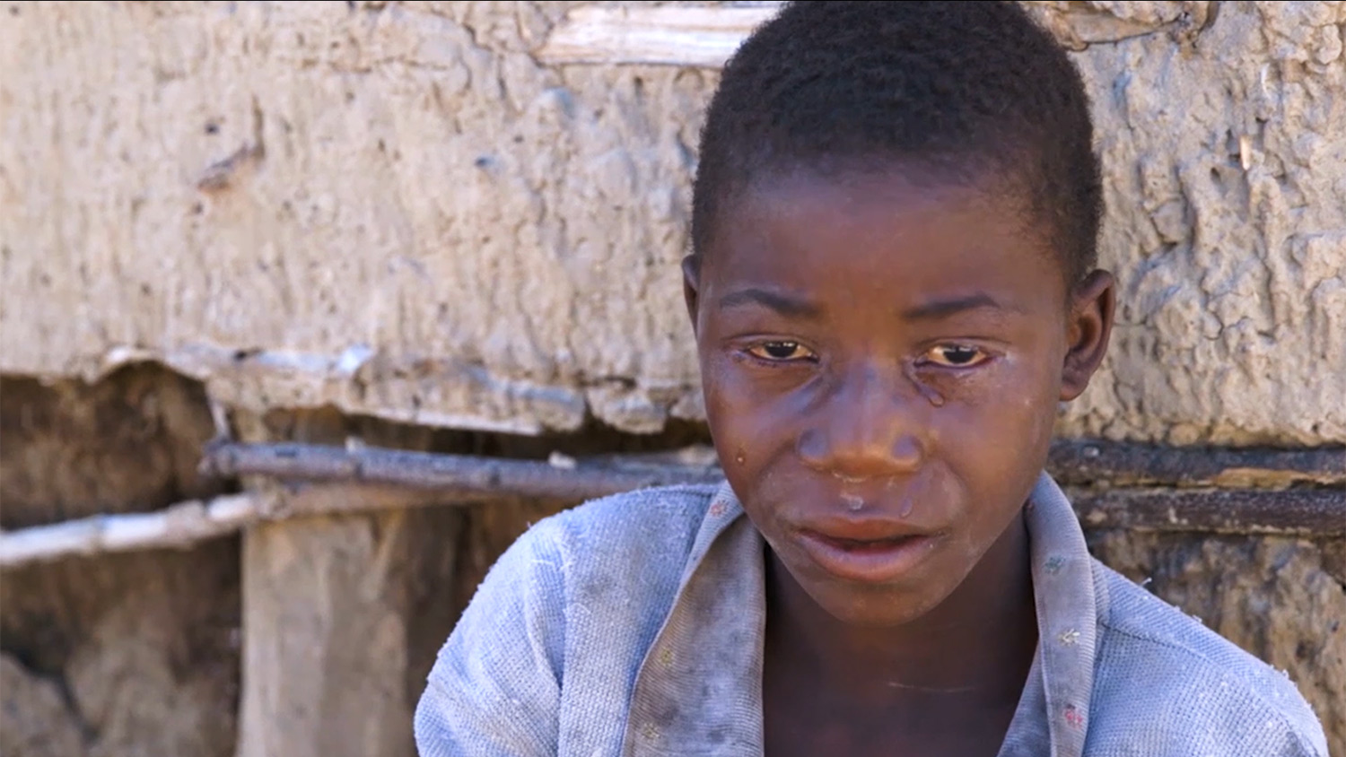 Will you protect more children like Pumelo from Trachoma | Sightsavers