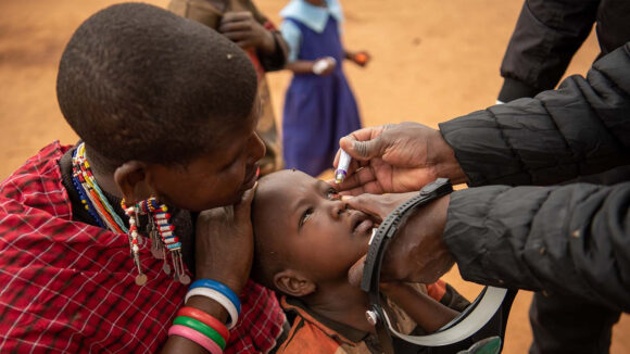 Naomi receives an application of ointment for her eyes to treat her trachoma infection.